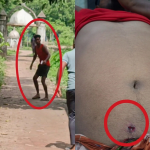 বাঞ্ছারামপুরে স্পিডবোট ঘাটে শিশুর ভাড়া নিয়ে বিরোধের জেরে সংঘর্ষ, গুলিবিদ্ধ জাহাঙ্গীর; ঢাকা মেডিকেলে ভর্তি