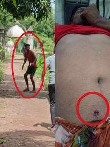 বাঞ্ছারামপুরে স্পিডবোট ঘাটে শিশুর ভাড়া নিয়ে বিরোধের জেরে সংঘর্ষ, গুলিবিদ্ধ জাহাঙ্গীর; ঢাকা মেডিকেলে ভর্তি