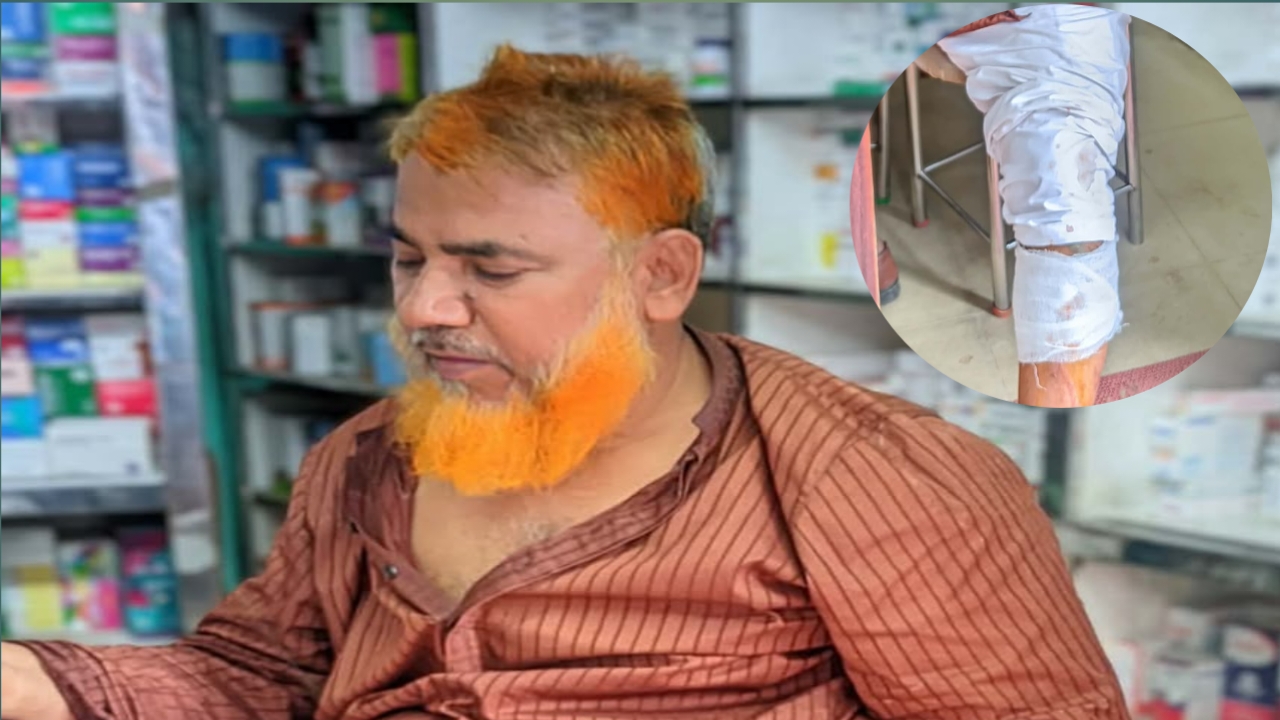 বাঞ্ছারামপুরে প্রবাসীর ওপর হামলার অভিযোগ, সাবেক চেয়ারম্যান আঃ আজিজ সহ ৮ জনের বিরুদ্ধে মামলা